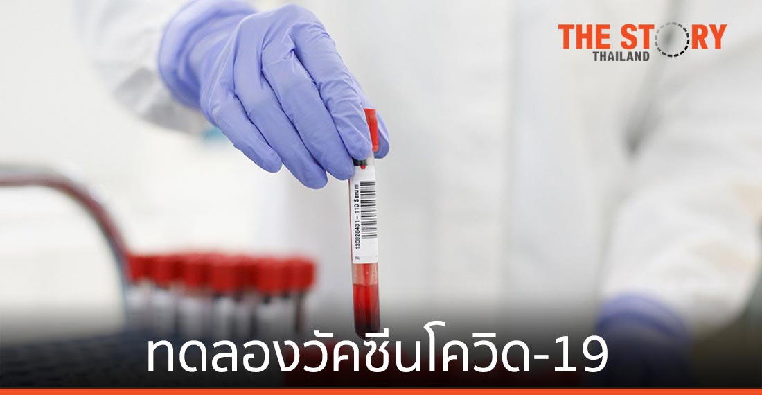 โรช ร่วมมือ โมเดอร์นา นำการตรวจหาภูมิต้านทานต่อเชื้อซาร์ส-โควี-ทู ไปใช้ในงานทดลองวัคซีนโควิด-19