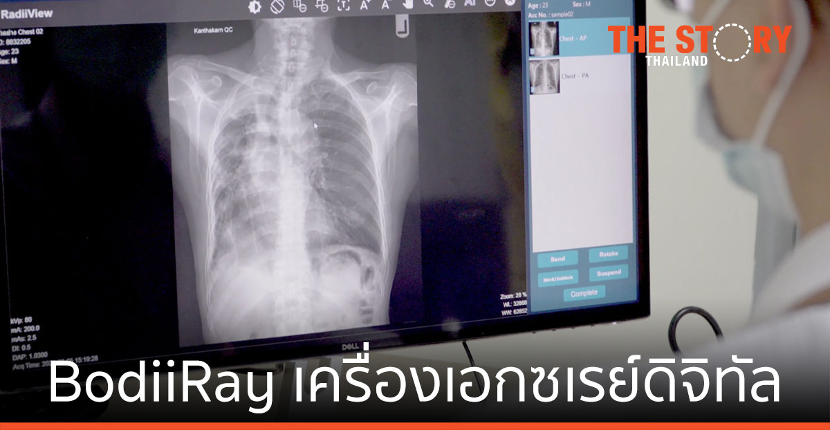 BodiiRay เครื่องเอกซเรย์ดิจิทัล นวัตกรรมไทยทำ เพื่ออุตสาหกรรมเครื่องมือแพทย์ที่ยั่งยืน