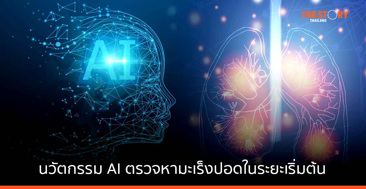 โรงพยาบาลบ้านแพ้ว ดีป้า และแอสตร้าเซนเนก้า นำ AI ตรวจหามะเร็งปอดในระยะเริ่มต้น ในโครงการ “ตรวจไว สู้ภัยมะเร็งปอด”