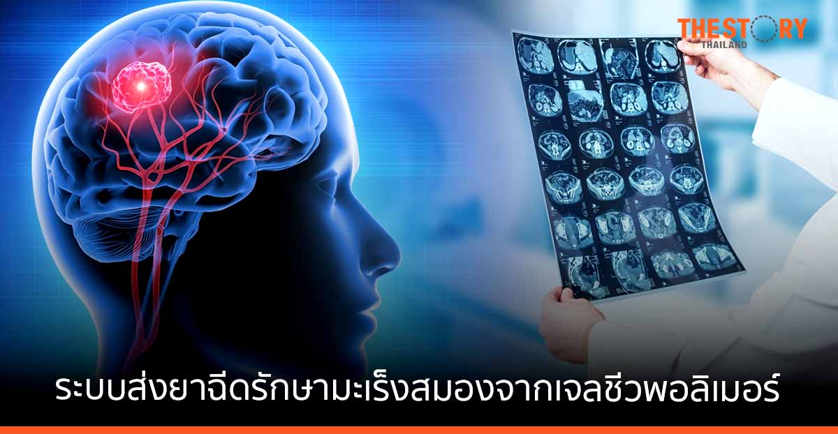 ครั้งแรกในอาเซียน... วิศวะมหิดล - แพทยศาสตร์ รามา คิดค้นนวัตกรรมพิชิตมะเร็งวิธีใหม่