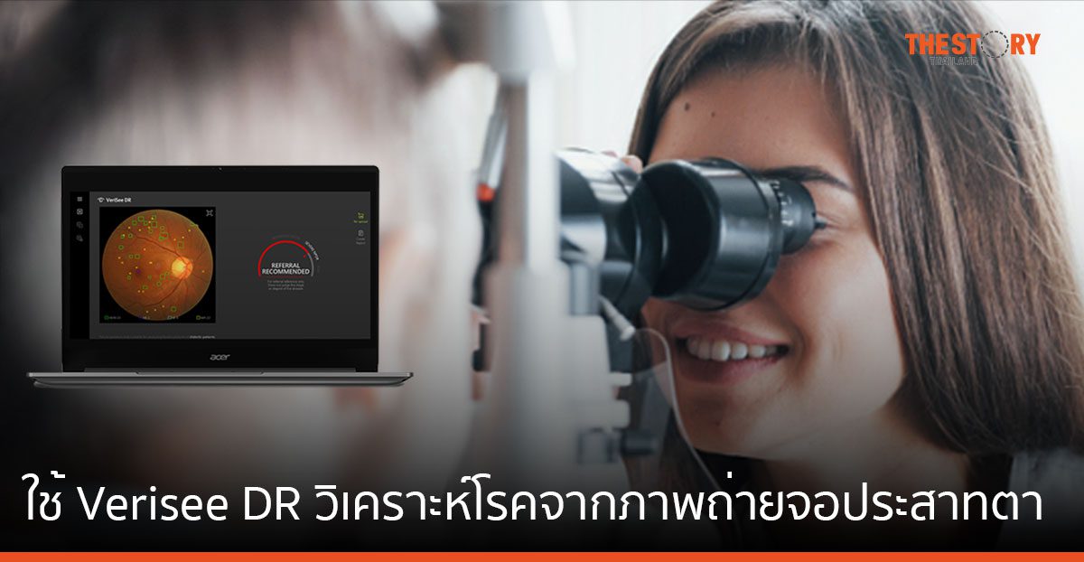 Acer ร่วมกับ 4 รพ. ทดลองใช้ซอฟต์แวร์ Verisee DR วินิจฉัยภาวะเสี่ยงโรคเบาหวานขึ้นจอประสาทตา