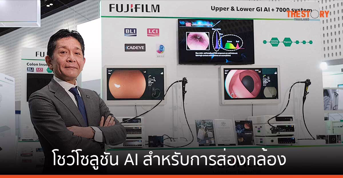 ฟูจิฟิล์ม โชว์โซลูชัน “CAD EYE” ใช้ AI ตรวจหามะเร็งระบบทางเดินอาหาร