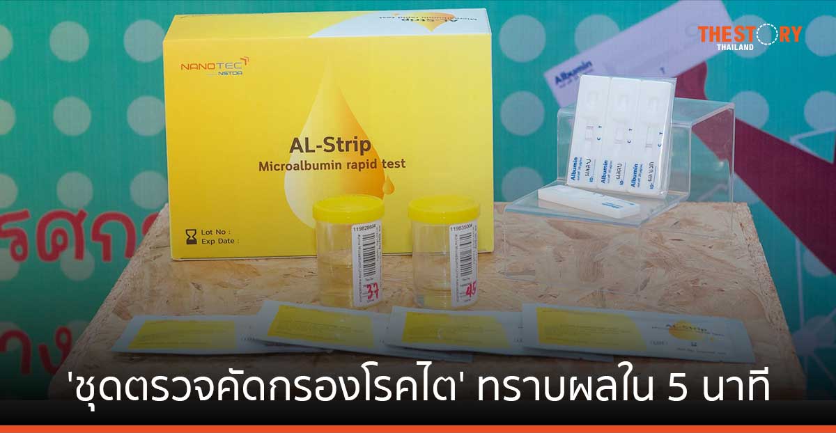 นักวิจัยนาโนเทค คิดค้น 'ชุดตรวจคัดกรองโรคไต' ทราบผลใน 5 นาที