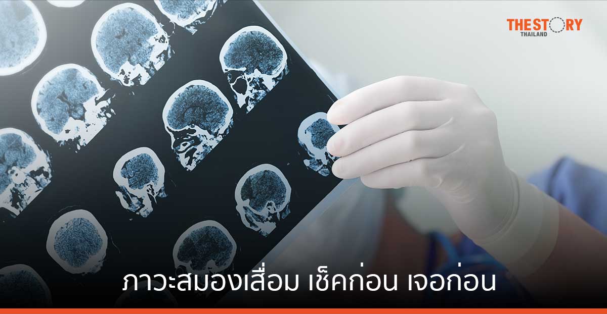 ภาวะสมองเสื่อม เช็คก่อน เจอก่อน ชะลอได้